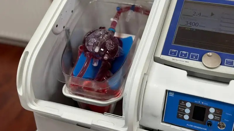 Врачи из Астаны могут лечить органы… вне тела